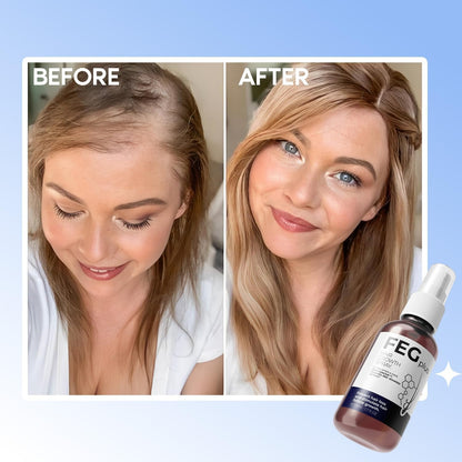 FEG PLUS 50ml Hair Growth Liquid Spray - Buy 2 Get 1 free!!